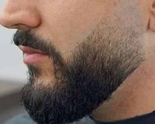 juste j barbe